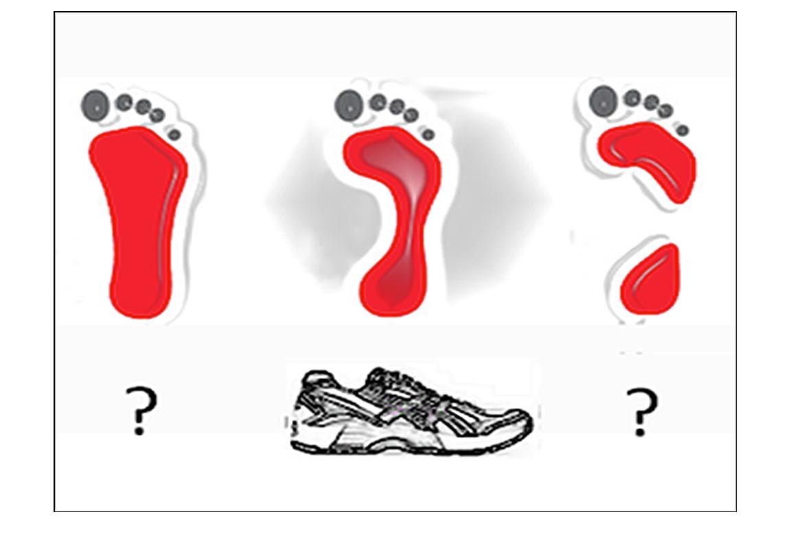 El dilema de los tenis